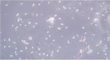 Spores of Nosema protozoa viewed under microscope.