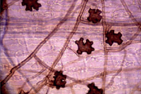Microscope image of rot on roots