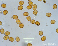 Microscope image of single celled organisms