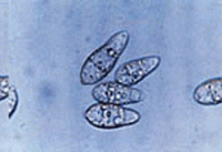 Pyricularia grisea under a microscope