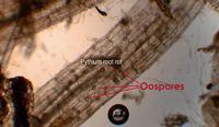 Pythium root rot oospores