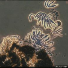 Venturia inequalis microscope image