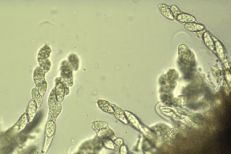 Botryosphaeria dothidea microscope image