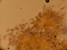 Gymnosporangium juniperi- virginianae teliospores