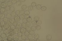 Monilinia vaccinii-corymbos microscope image