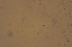 Phomopsis vaccinii microscope image