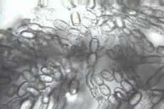 Uncinula necator microscope image
