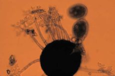 Uncinula necator under a microscope