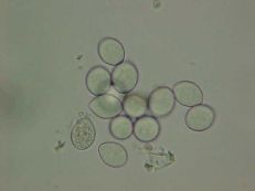 Plasmopara viticola under a microscope