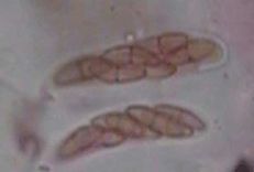 Mycosphaerella angulata microscope image