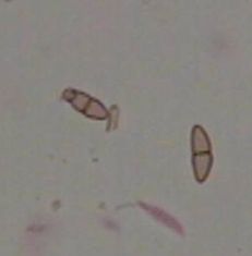 Mycosphaerella angulata microscope image