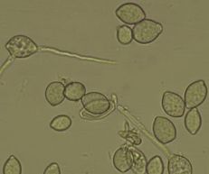 Monilinia fructicola under microscope