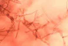 Cladosporium carpophilum microscope image