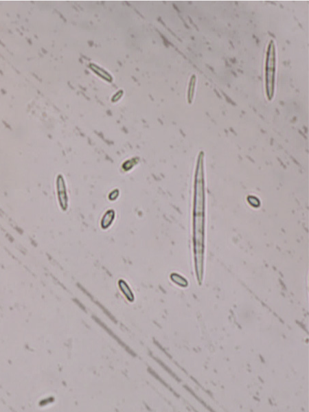 Microscopic image of microconidia and macrocondia of Fusarium oxysporum f. sp. niveum.