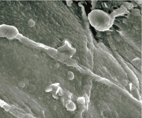 Electron micrograph of F. oxysporum f. sp. niveum on a watermelon seed coat.
