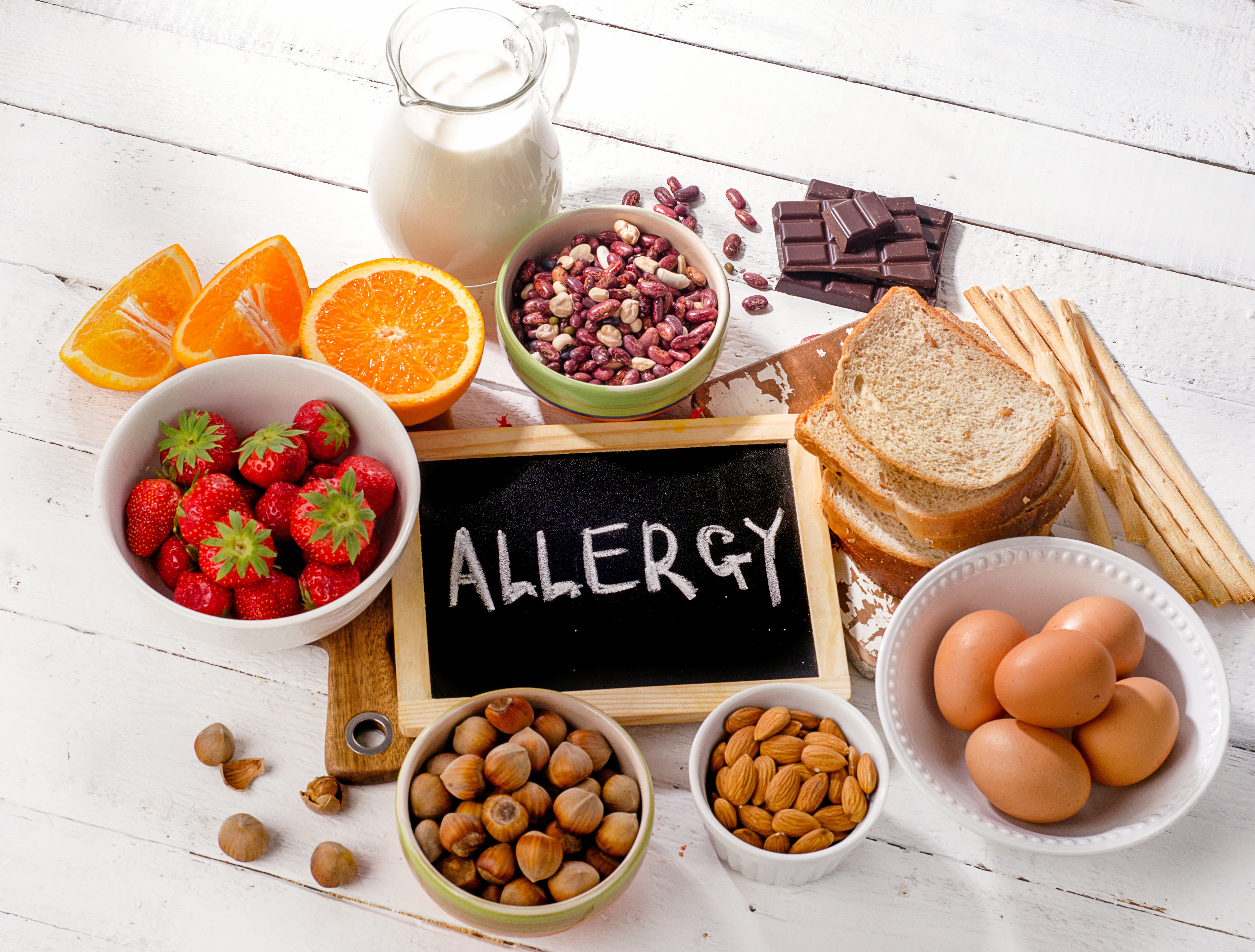 Various foods around a chalkboard reading "Allergy"