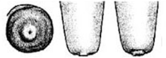 Illustration of the bottom and side of a teat with a smooth hyperkeratic ring