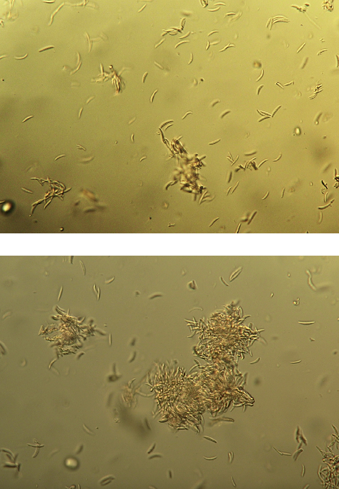 spores seen through a microscope with a yellow tint