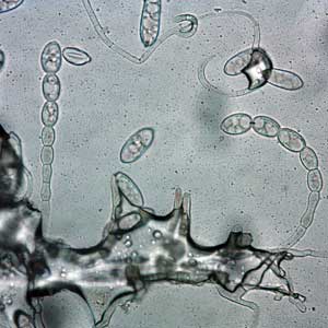 microscopic image of conidial chain