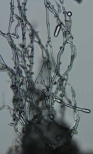microscopic image of mycelium