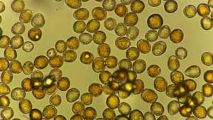 micrograph of urediniospores