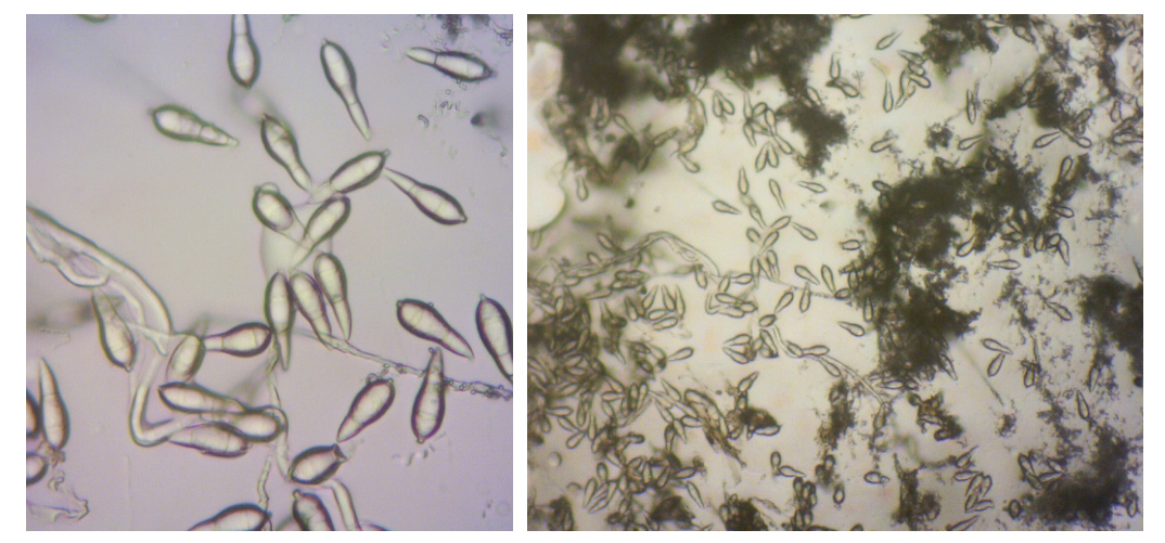 Microscopic images of Pyricularia grisea.