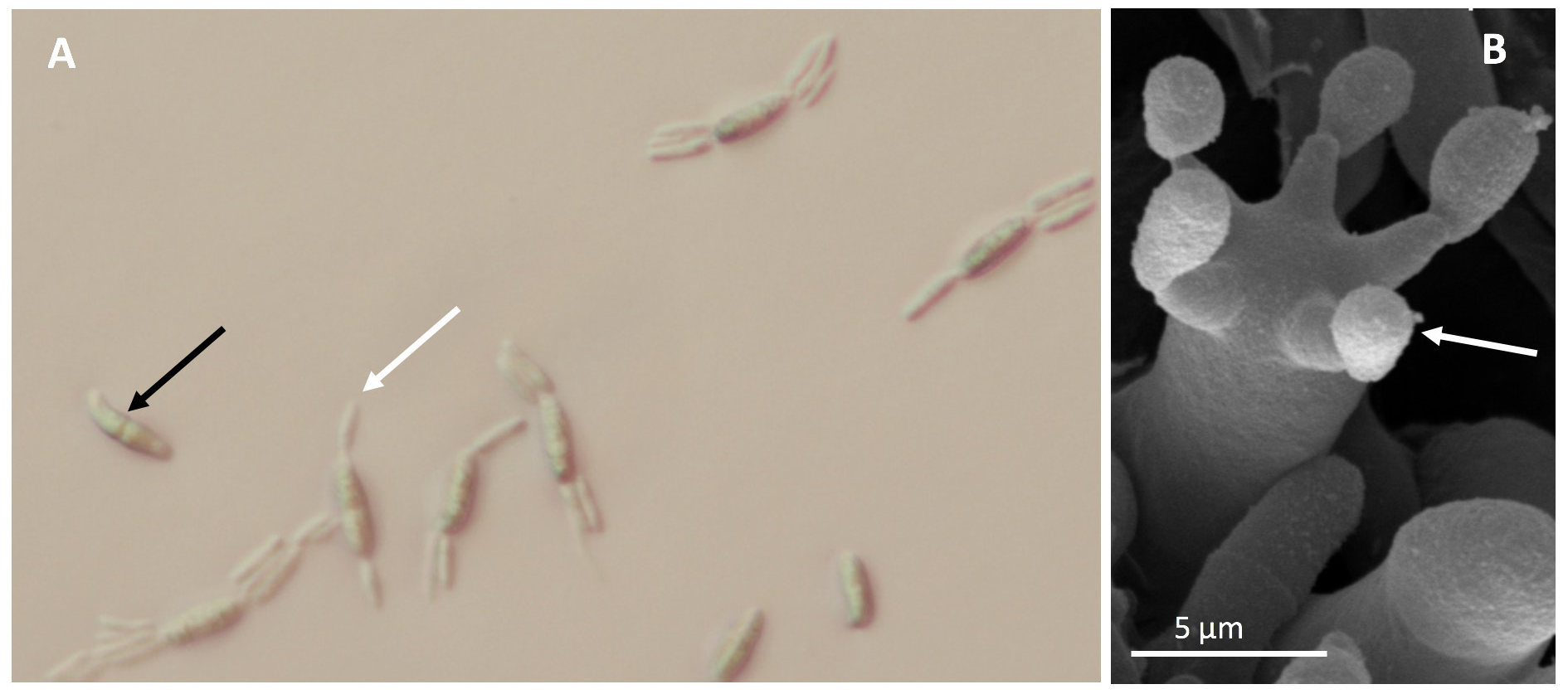 microscope images of Basidiospores germinating