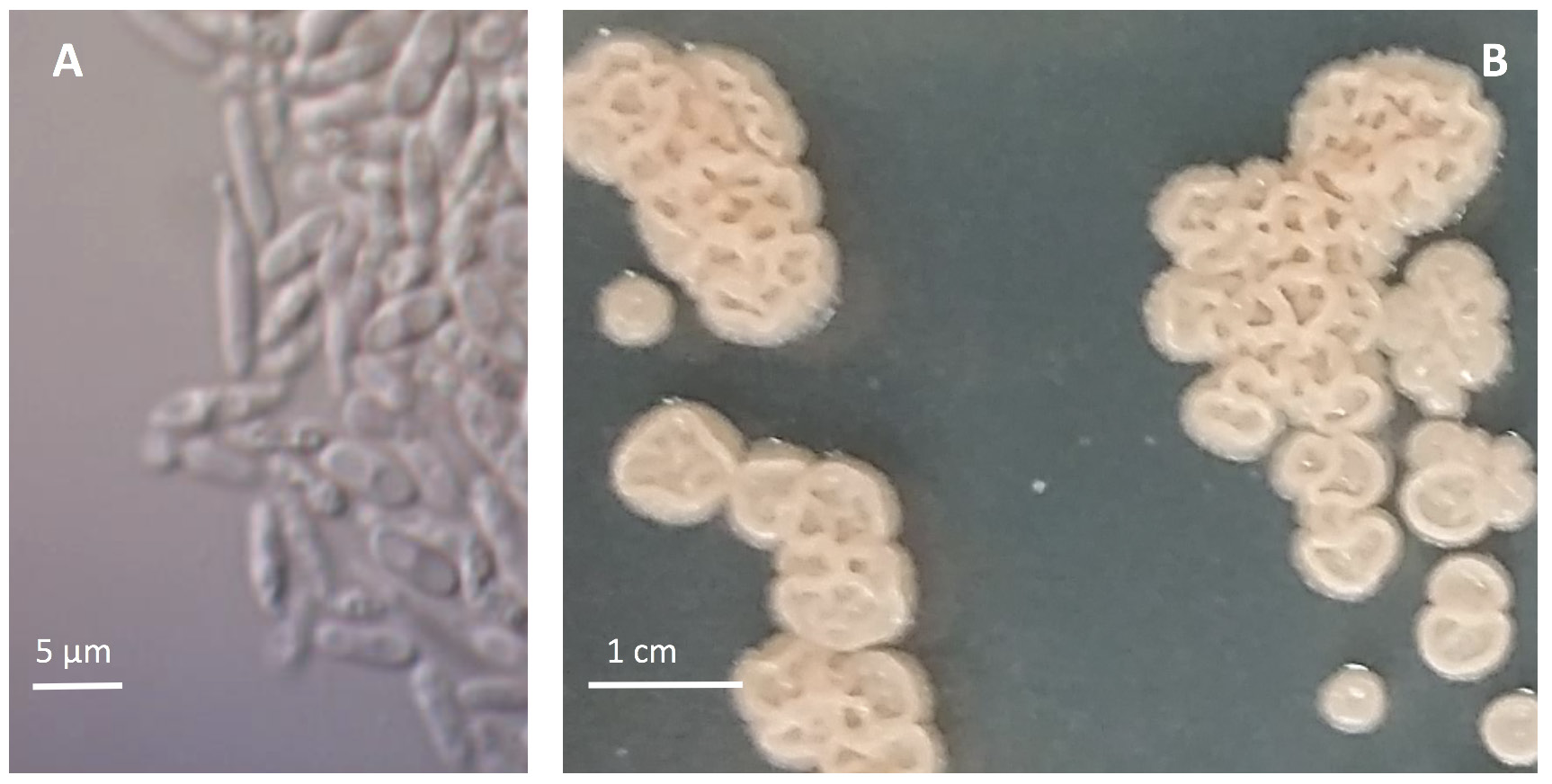 microscope images of colonies of E. masculosum