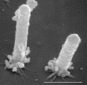 Xylella fastidiosa cells in an electron microscope image as elongated cells attached to a surface at one end.