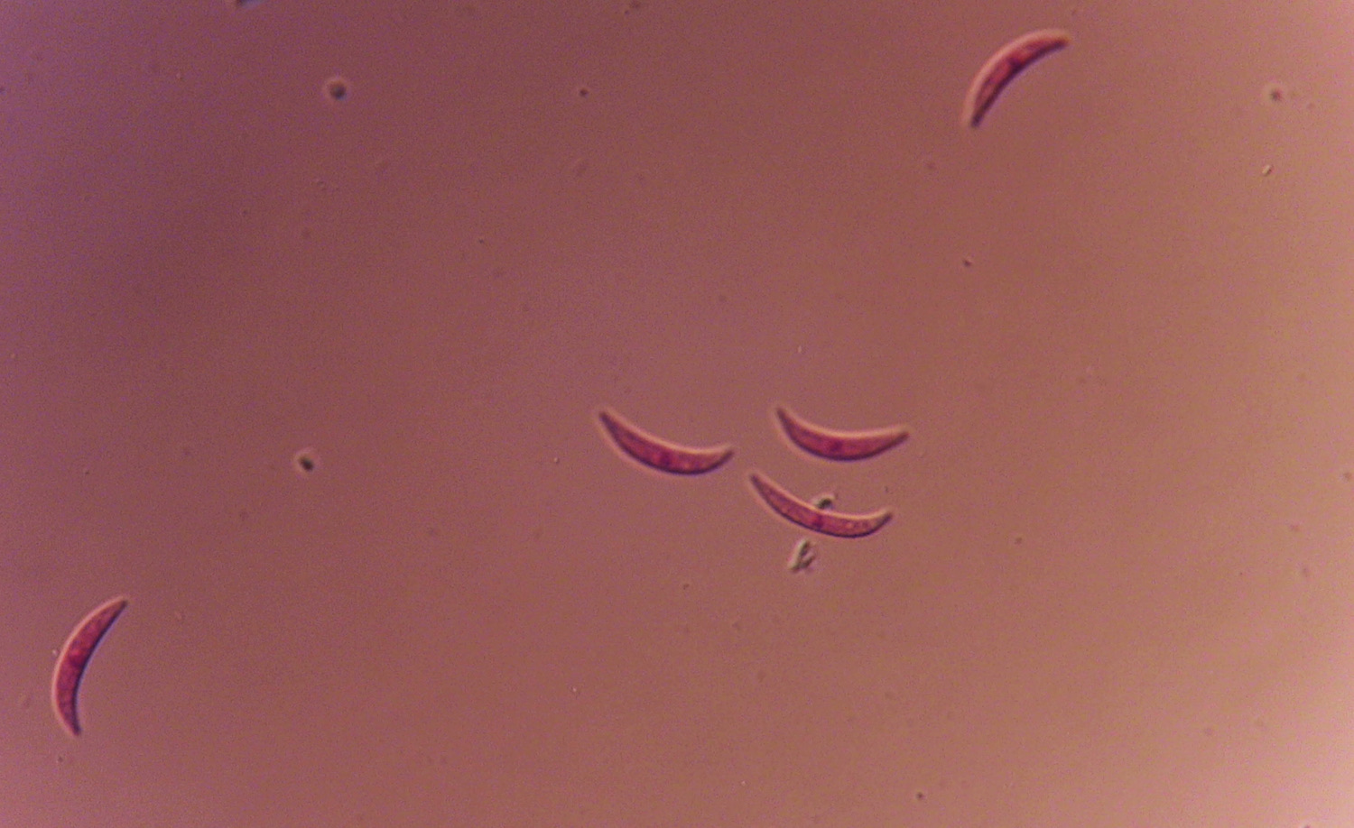 Under a microscope, spores of C. graminicola look like crescents