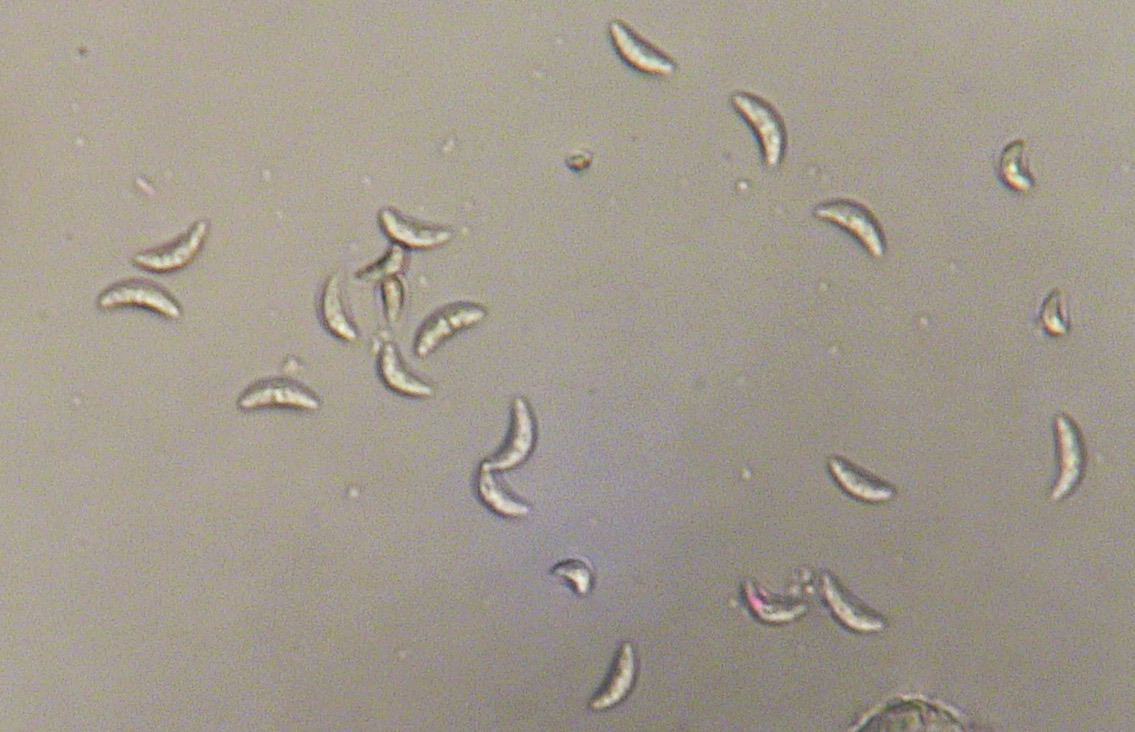 The causal organism of anthracnose looks like crescents under a microscope