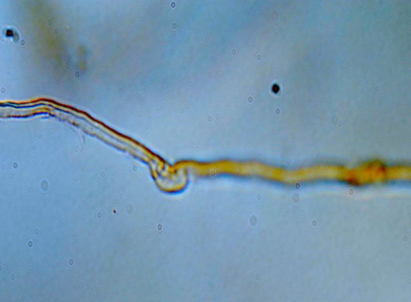 a strand of near microscopic plant matter is joined to a larger limb by another by a bulbous node