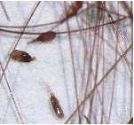 Figure 2: Nits (lice eggs)