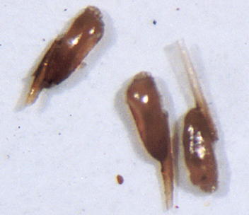 Nits from head lice, removed from hair and on a white background