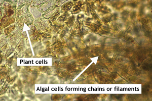 Figure 1. Microscopic image of filaments (algal cells) of Cephaleuros virescens growing across a blackberry cane (mainly observed between the cuticle and epidermal plant cells) at 400X magnification.