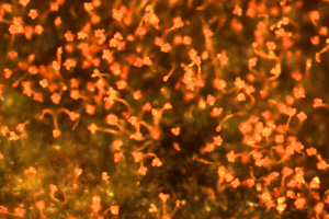 Microscope image of orange sporangiophores