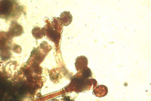 Microscope image of sporangiophores