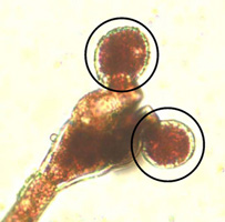 Sporangiophore with individual zoosporangia circled