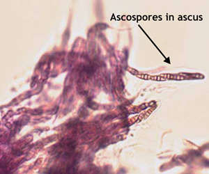 Microscope image of ascospores.