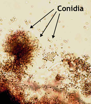 Figure 1. Ascospores (top image) and conidia (bottom) at 400X magnification.
