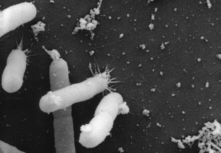 Electron microscope photograph of bacteria