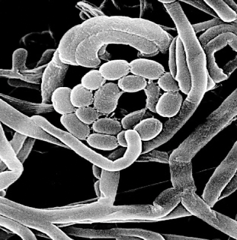 Microscopic actinomycetes