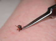 Use tweezers to remove ticks. Pinch the tick close to the mouthparts to remove as much as possible. If the tick head is left behind, don't worry. Having a tick attach itself to your skin is like having a thorn. Your body will expel it over time.