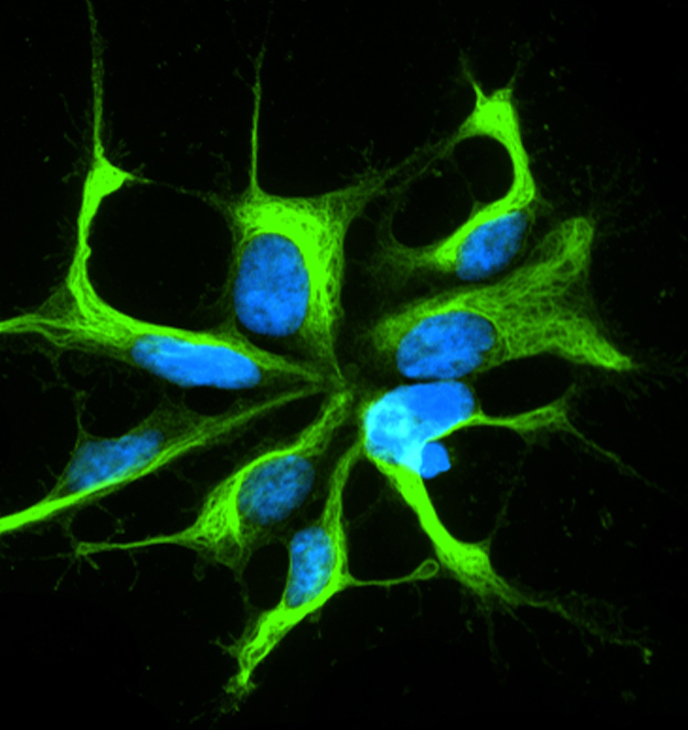Neural progenitors are used at UGA's Regenerative Bioscience Center to determine endocrine active compound-induced alterations in key human neural cellular events. (Credit: Regenerative Bioscience Center)