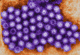 This electron micrograph provides an close-up view of norovirus particles. Being close to the actual particles will cause what is commonly called a stomach virus.
