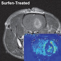 MRI imaging showing the control vs. the surfen-treated example. (Photo provided by UGA Regenerative Bioscience Center)