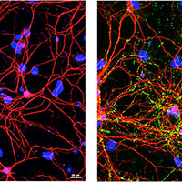 Left, imaging of healthy neurons from mouse brain. Right, imaging of damaged neurons by PD protein clumps.