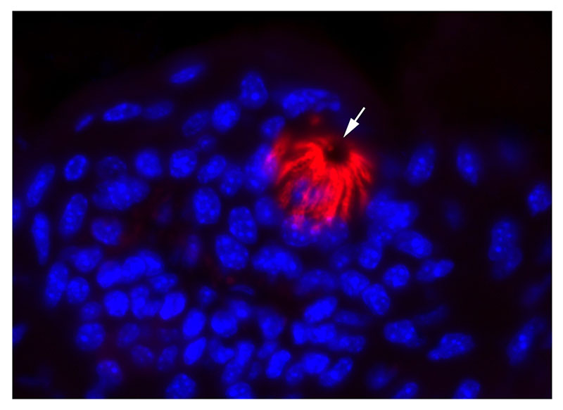 An increasing number of COVID-19 patients have reported losses of smell and/or taste, prompting the CDC to add it to the growing list of symptoms for COVID-19. The arrow in the photo points to a taste bud (red) with a taste "pore," a channel opening that communicates with the oral cavity.